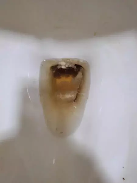 马桶除垢除臭用什么最好使(1)