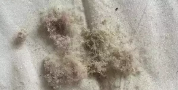 坐沙发身上痒怎么处理(11)