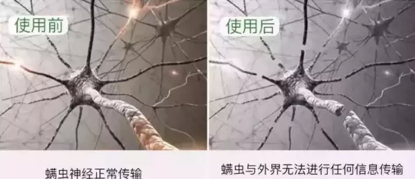 坐沙发身上痒怎么处理(13)