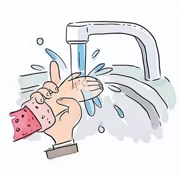 小面积烧伤冷水至少冲淋多长时间(1)