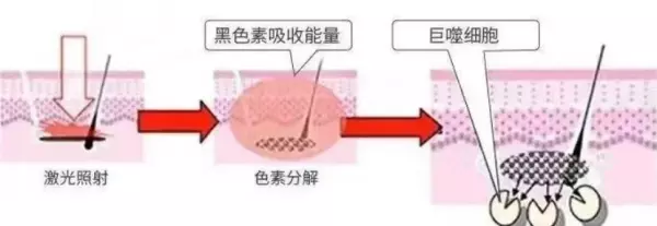 Q开关激光是和调Q激光一样吗(2)