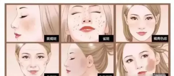 Q开关激光是和调Q激光一样吗(3)
