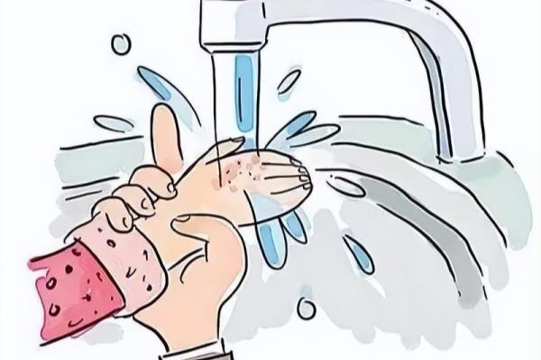 小面积烧伤冷水至少冲淋多长时间.