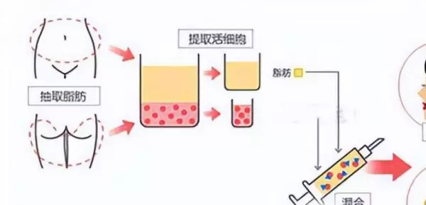 艾米乐填充的主要成分是什么(2)