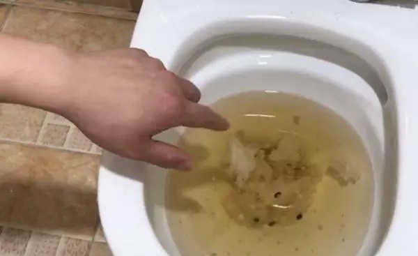 智能马桶下水慢感觉堵了怎么办(1)