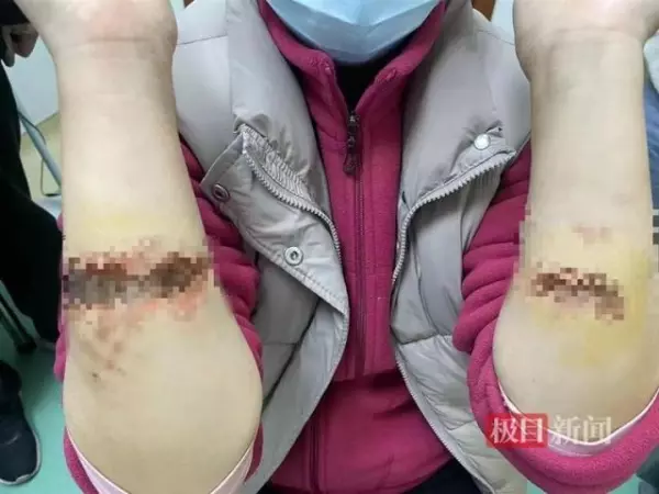 倒管子是啥意思网络用语(4)