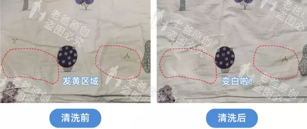 枕心上的黄污渍怎么去除(5)