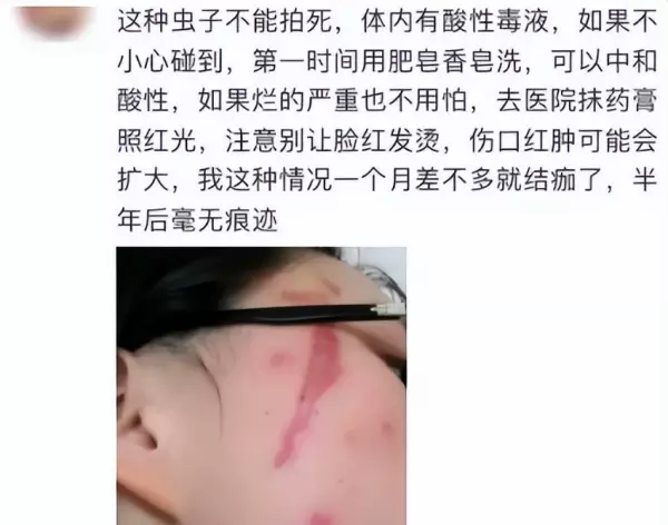 蛾蚋会吸血吗会咬人吗(3)