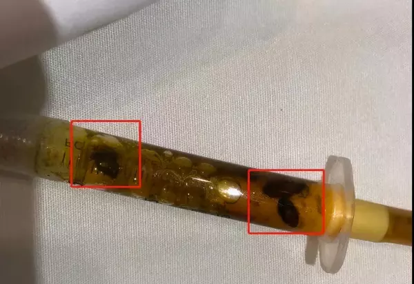 瓜子虫子是什么意思(1)