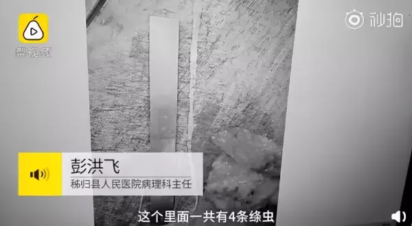 瓜子虫子是什么意思(3)
