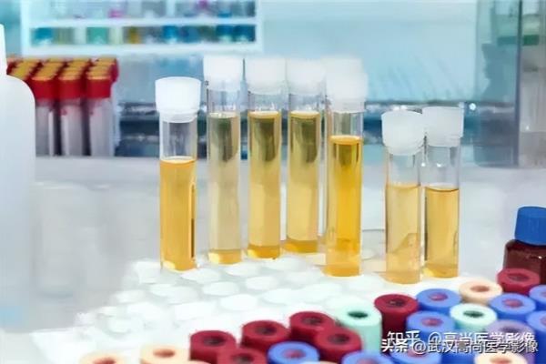尿胆原normal1是什么意思.