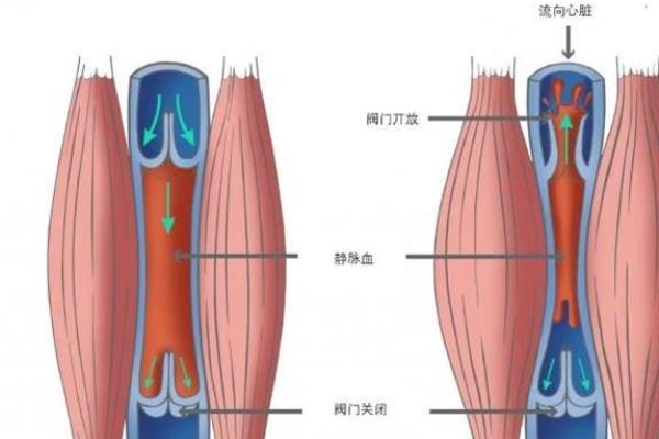挺床上时间长了会不会引起血栓.