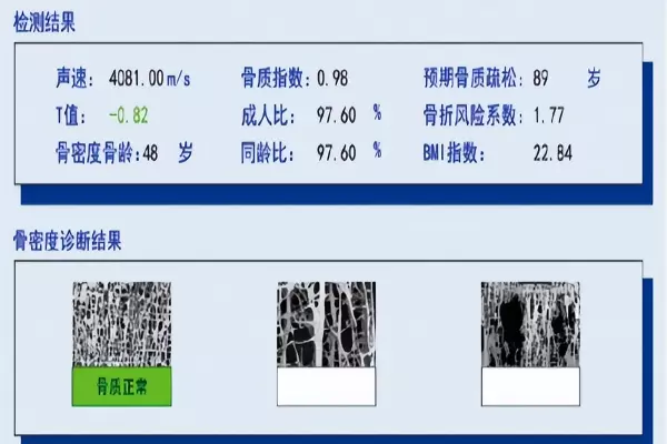 超平仪怎么使用方法(9)