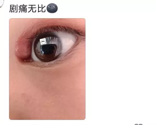 火夹子疙瘩是什么导致的(7)