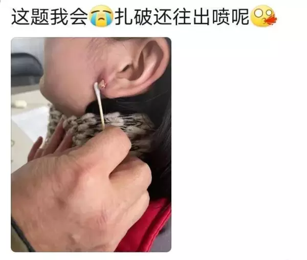 火夹子疙瘩是什么导致的(9)