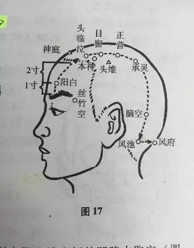 目窗穴在哪个位置(3)