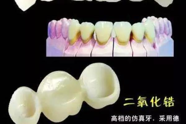 全瓷牙和二氧化锆牙有什么区别.
