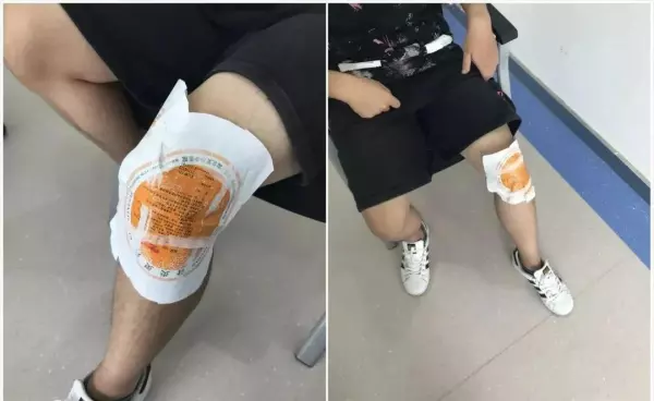 李大华膏药管用吗(13)