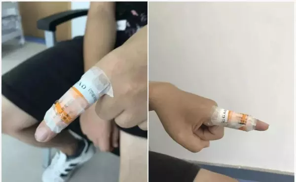 李大华膏药管用吗(16)
