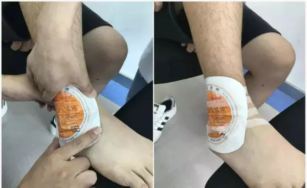 李大华膏药管用吗(17)