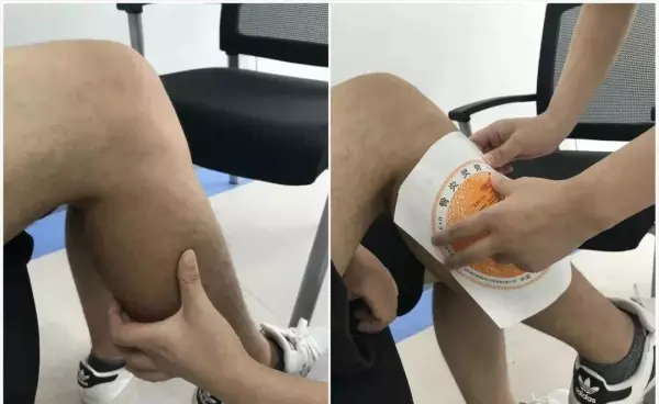 李大华膏药管用吗(23)