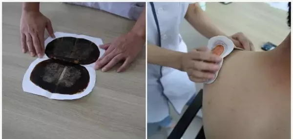 李大华膏药管用吗(5)