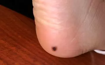 脚踏开关红黑白三线怎么接(17)