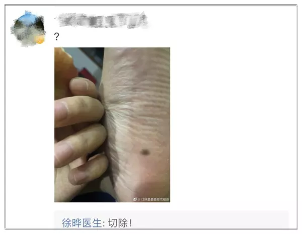 脚踏开关红黑白三线怎么接(2)