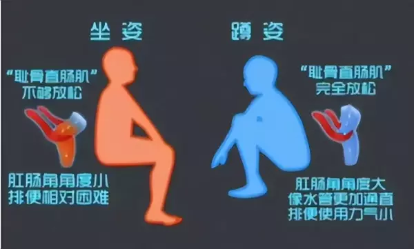净身盆好还是洁便器好(2)