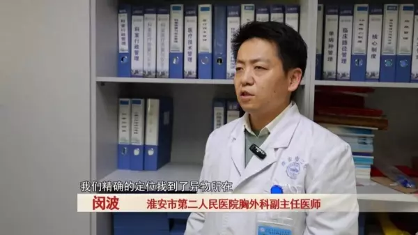 清洁球丝不小心吃肚子里会怎么样(1)