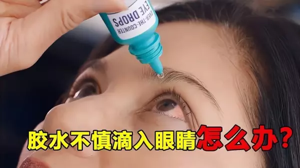 大力胶用什么方法可以弄掉(2)