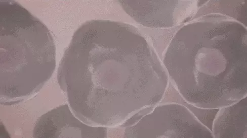 阴色素缺失白斑是怎么造成的原因(3)