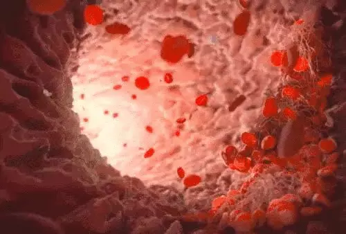 阴色素缺失白斑是怎么造成的原因(4)