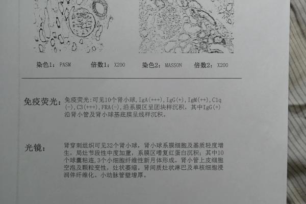 耐能液怎样使用和功效.