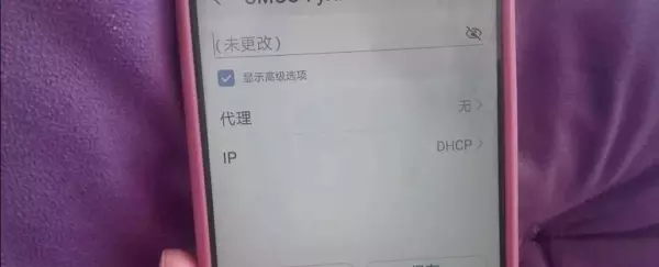 无限网络显示已连接,但是没有网络,有什么办法可以恢复(6)