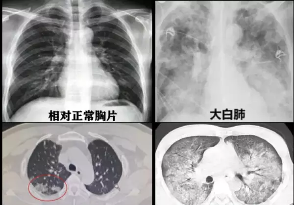 300mmhg等于多少mpa(1)