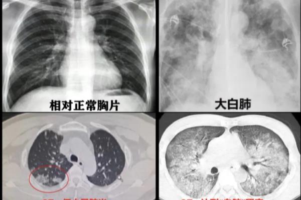 300mmhg等于多少mpa.